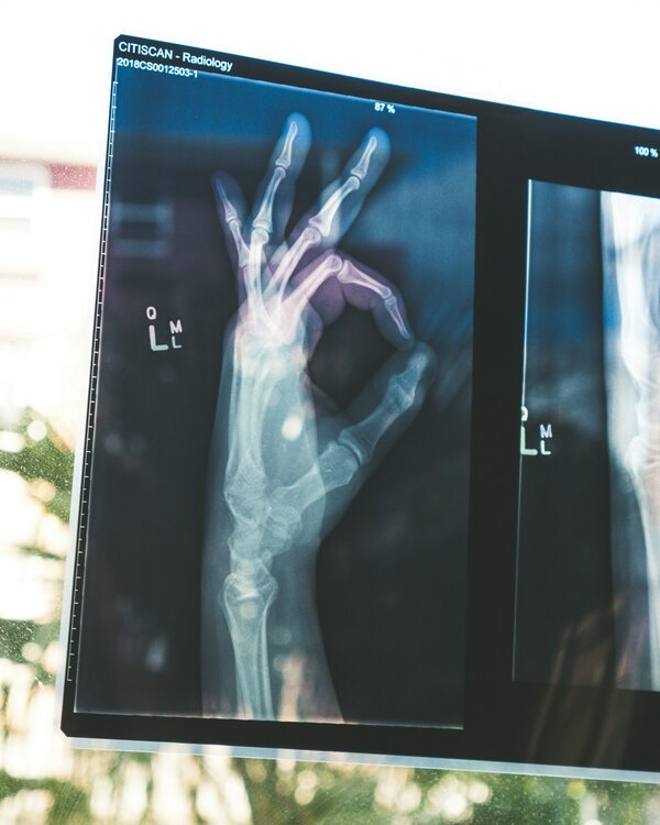 Röntgenaufnahme einer Hand, die ein „OK“-Zeichen macht – Darstellung moderner bildgebender Verfahren.